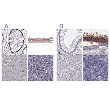 Anti-GRK1 antibody produced in rabbit Prestige Antibodies&#174; Powered by Atlas Antibodies, affinity isolated antibody