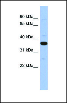 Anti-MYD88 antibody produced in rabbit affinity isolated antibody