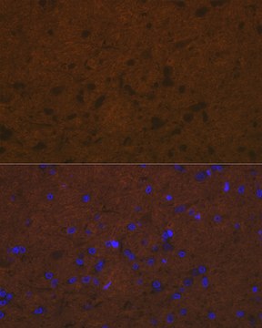 Anti-Talin 2 Antibody, clone 7D1Y0, Rabbit Monoclonal