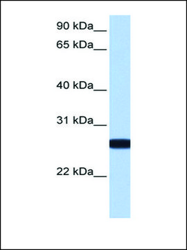 Anti-IL13RA2 (AB1) antibody produced in rabbit affinity isolated antibody