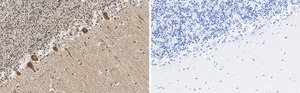 Anti-GluR-2 Antibody, clone 1K20 ZooMAb® Rabbit Monoclonal recombinant, expressed in HEK 293 cells