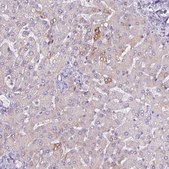 Anti-PLIN2 antibody produced in rabbit Prestige Antibodies® Powered by Atlas Antibodies, affinity isolated antibody, buffered aqueous glycerol solution