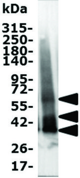 MT1 (Melatonin Receptor 1)