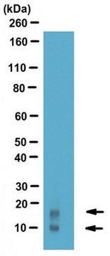 Anti-Acylation Stimulating Protein Antibody from rabbit