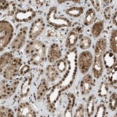 Anti-TLK1 antibody produced in rabbit Prestige Antibodies® Powered by Atlas Antibodies, affinity isolated antibody, buffered aqueous glycerol solution