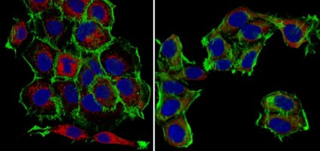 Anti-S100A4 Antibody, clone 9D5.1 clone 9D5.1, from mouse