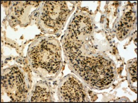 Anti-UBR5 (C-terminal) antibody produced in goat affinity isolated antibody, buffered aqueous solution