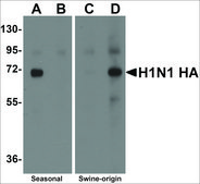 Anti-Seasonal H1N1 Hemagglutinin antibody produced in rabbit affinity isolated antibody, buffered aqueous solution