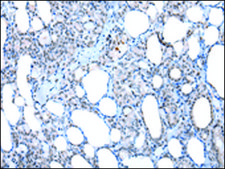 Anti-XAB2 affinity isolated antibody
