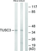 Anti-TUSC3 antibody produced in rabbit affinity isolated antibody
