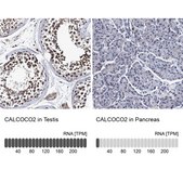 Anti-CALCOCO2 antibody produced in rabbit Prestige Antibodies® Powered by Atlas Antibodies, affinity isolated antibody, buffered aqueous glycerol solution, Ab1