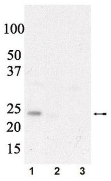 Anti-phospho eIF4E (Ser209) Antibody Upstate&#174;, from rabbit