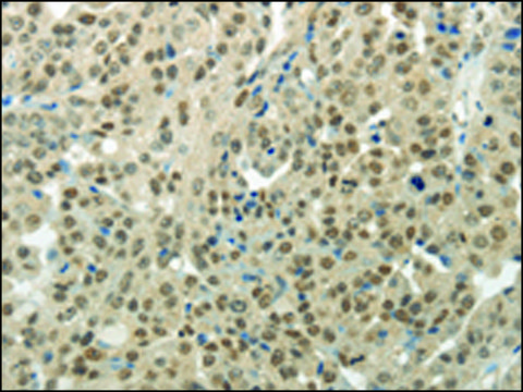 Anti-BAZ1B affinity isolated antibody