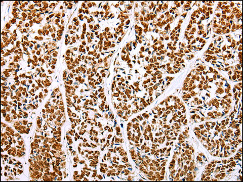 Anti-ABCA1 affinity isolated antibody