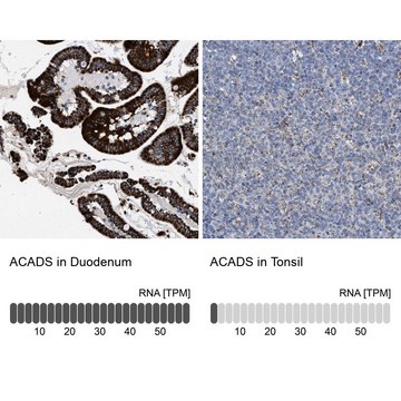 Anti-ACADS antibody produced in rabbit Prestige Antibodies&#174; Powered by Atlas Antibodies, affinity isolated antibody, buffered aqueous glycerol solution, Ab2