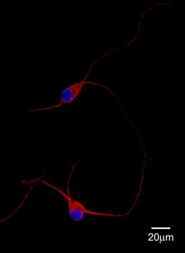 Anti-MAP2 Antibody Chemicon&#174;, from chicken