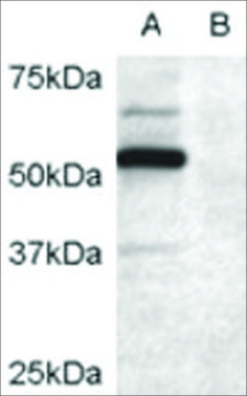 Anti-DCDC2 antibody produced in goat affinity isolated antibody, buffered aqueous solution