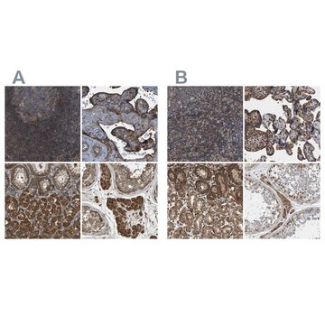 Anti-SAMD9L antibody produced in rabbit Prestige Antibodies&#174; Powered by Atlas Antibodies, affinity isolated antibody, buffered aqueous glycerol solution, Ab3