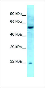 Anti-RAB27A antibody produced in rabbit affinity isolated antibody