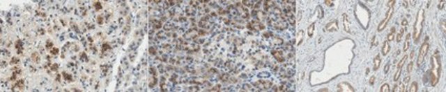 Anti-ARHGAP36 Antibody, clone 12D10.1 clone 12D10.1, from mouse