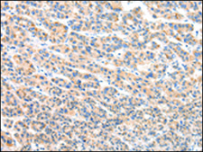 Anti-VPS54 affinity isolated antibody