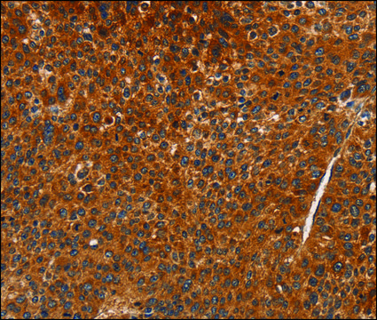 Anti-CDK19 antibody produced in rabbit affinity isolated antibody