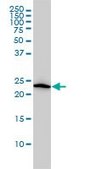 Monoclonal Anti-VBP1 antibody produced in mouse clone 3D11, purified immunoglobulin, buffered aqueous solution