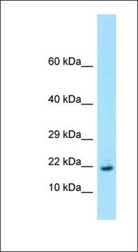 Anti-RPL26 antibody produced in rabbit affinity isolated antibody