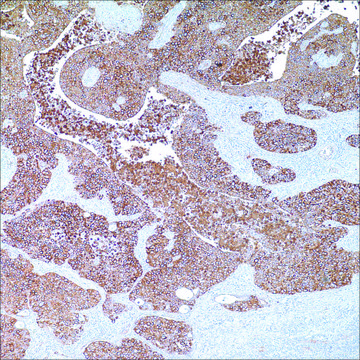 Cytokeratin, HMW (AE3) Mouse Monoclonal Antibody