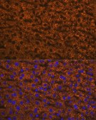 Anti-ANGPTL3 antibody produced in rabbit