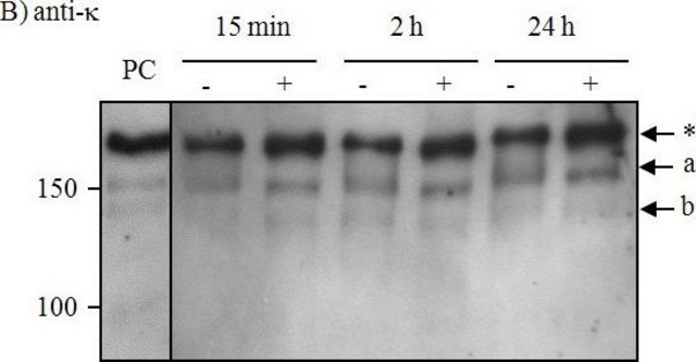 抗-人Kappa轻链（结合和游离）&#8722;过氧化物酶 山羊抗 affinity isolated antibody, buffered aqueous solution