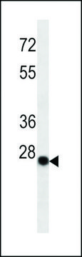 MONOCLONAL ANTI-KAPPA LIGHT CHAIN antibody produced in mouse clone HP6053, IgG fraction of antiserum, buffered aqueous solution