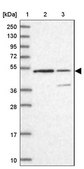 Anti-KNOP1 antibody produced in rabbit Prestige Antibodies® Powered by Atlas Antibodies, affinity isolated antibody, buffered aqueous glycerol solution