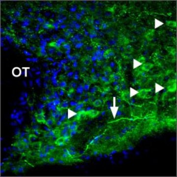 Anti-P2X1 Purinergic Receptor antibody produced in rabbit affinity isolated antibody, lyophilized powder