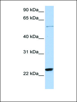 Anti-ZNF83 antibody produced in rabbit affinity isolated antibody