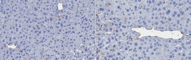 Anti-PLVAP Antibody, clone MECA-32 clone MECA-32, from rat