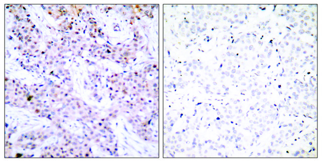 Anti-Estrogen Receptor-&#945; antibody produced in rabbit affinity isolated antibody