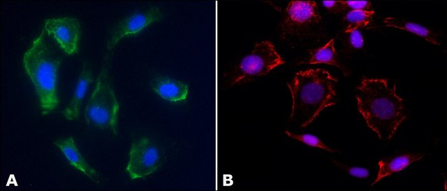 Anti-Caveolin-1 antibody produced in rabbit IgG fraction of antiserum, buffered aqueous solution