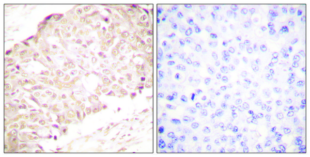 Anti-SENP1 antibody produced in rabbit affinity isolated antibody