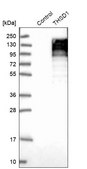 Anti-THSD1 antibody produced in rabbit Prestige Antibodies® Powered by Atlas Antibodies, affinity isolated antibody, buffered aqueous glycerol solution