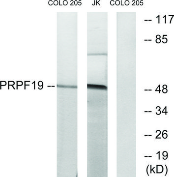 Anti-PRPF19 antibody produced in rabbit affinity isolated antibody