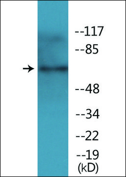 Anti-phospho-TAK1 (pThr184) antibody produced in rabbit affinity isolated antibody