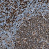 Anti-HLA-DPB1 antibody produced in rabbit Prestige Antibodies® Powered by Atlas Antibodies, affinity isolated antibody, buffered aqueous glycerol solution