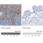 Monoclonal Anti-DYSF antibody produced in mouse Prestige Antibodies® Powered by Atlas Antibodies, clone CL10888, purified antibody (Protein A)