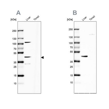 Anti-NADK2 antibody produced in rabbit Prestige Antibodies&#174; Powered by Atlas Antibodies, affinity isolated antibody, buffered aqueous glycerol solution