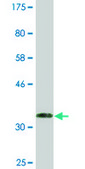Monoclonal Anti-RRM2B antibody produced in mouse clone 6C1, ascites fluid