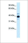 Anti-HNRNPC antibody produced in rabbit affinity isolated antibody