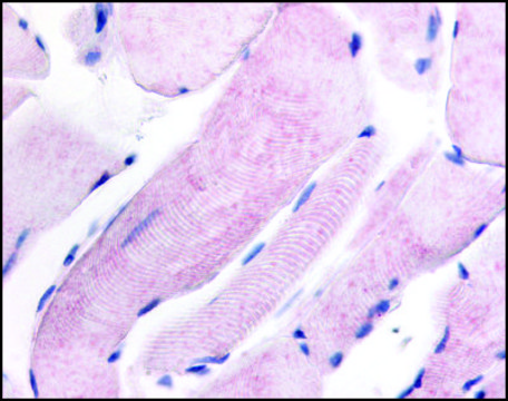 Anti-PRKWNK1 (AB1) antibody produced in rabbit affinity isolated antibody, buffered aqueous solution