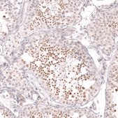 Monoclonal Anti-Cdk19 Antibody Produced In Mouse Prestige Antibodies® Powered by Atlas Antibodies, clone CL14116, affinity isolated antibody, buffered aqueous glycerol solution