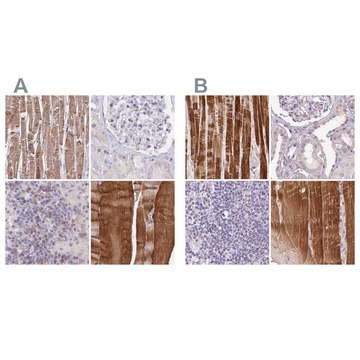 Anti-FAM168B antibody produced in rabbit Prestige Antibodies&#174; Powered by Atlas Antibodies, affinity isolated antibody, buffered aqueous glycerol solution